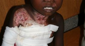 Fotogalerie > St. Gabriel's Hospital: 800x600_hospital-30